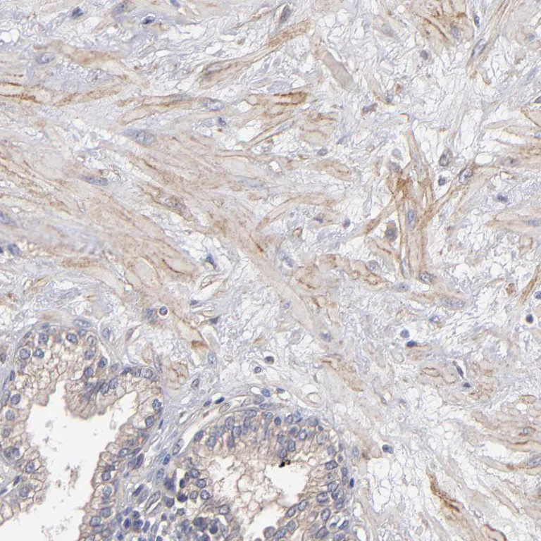 Immunohistochemistry (Formalin/PFA-fixed paraffin-embedded sections) - Anti-Dystrophin antibody (AB251665)