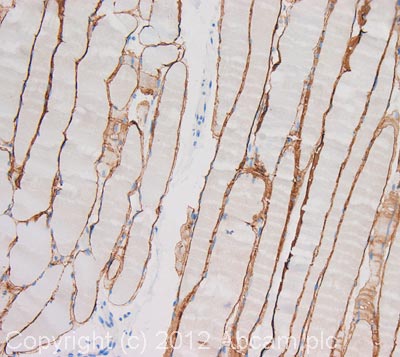 Immunohistochemistry (Formalin/PFA-fixed paraffin-embedded sections) - Anti-Dystrophin antibody (AB85302)
