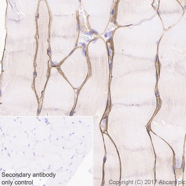 Immunohistochemistry (Formalin/PFA-fixed paraffin-embedded sections) - Anti-Dystrophin antibody [EPR21189] (AB218198), expandable thumbnail