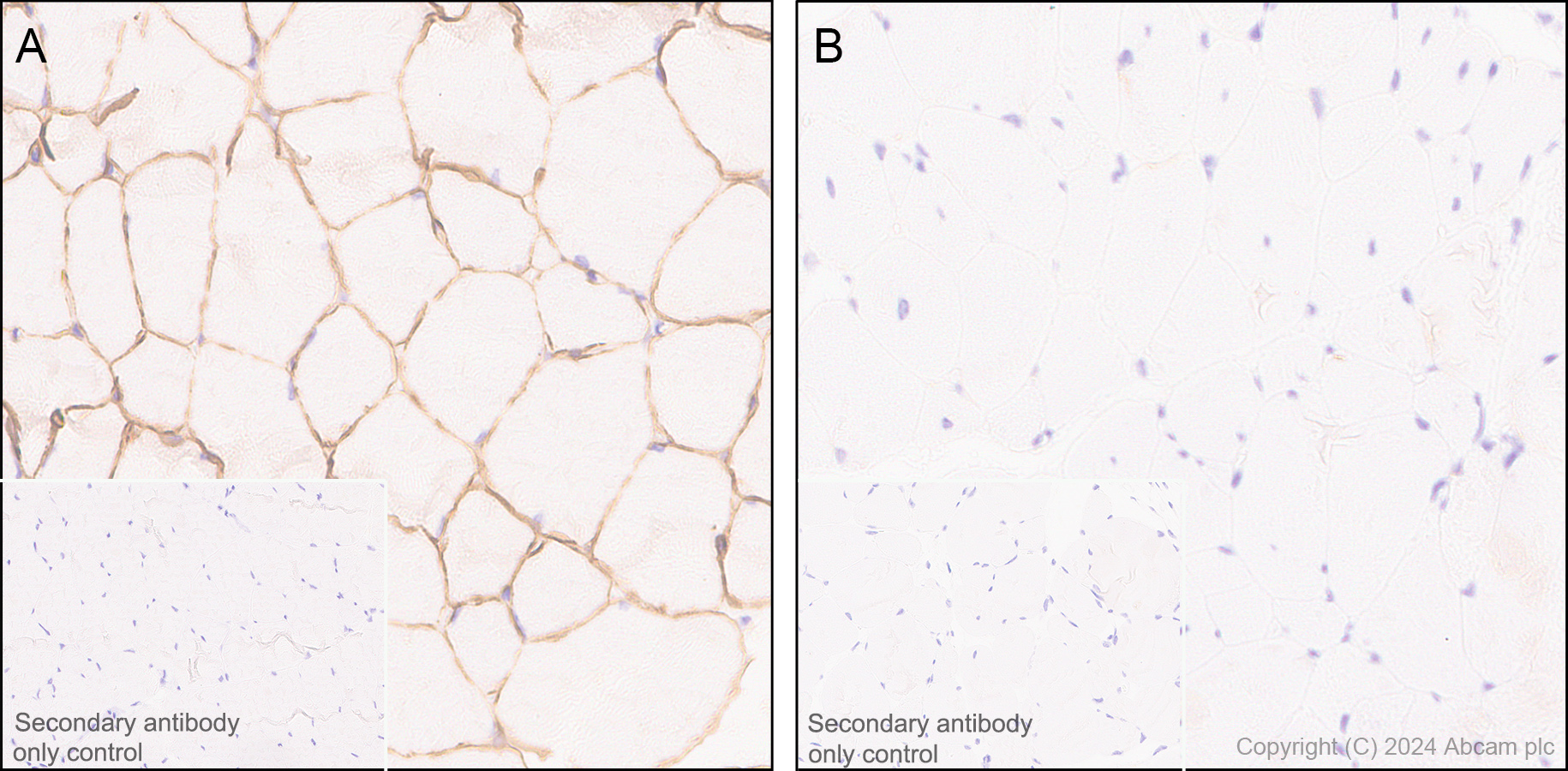 Immunohistochemistry (Formalin/PFA-fixed paraffin-embedded sections) - Anti-Dystrophin antibody [EPR21189] (ab218198), expandable thumbnail