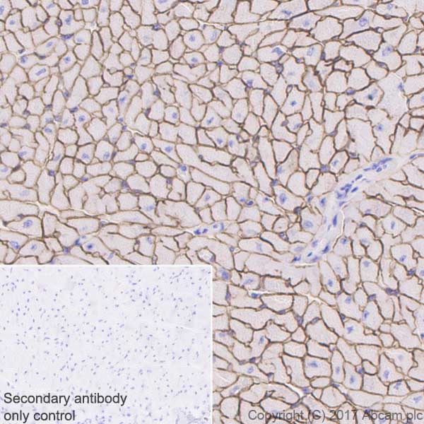 Immunohistochemistry (Formalin/PFA-fixed paraffin-embedded sections) - Anti-Dystrophin antibody [EPR21189] (AB218198), expandable thumbnail