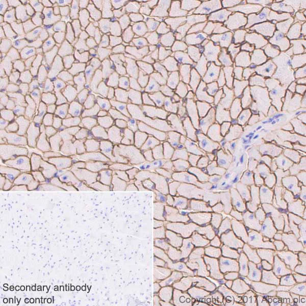 Immunohistochemistry (Formalin/PFA-fixed paraffin-embedded sections) - Anti-Dystrophin antibody [EPR21189] (AB218198)