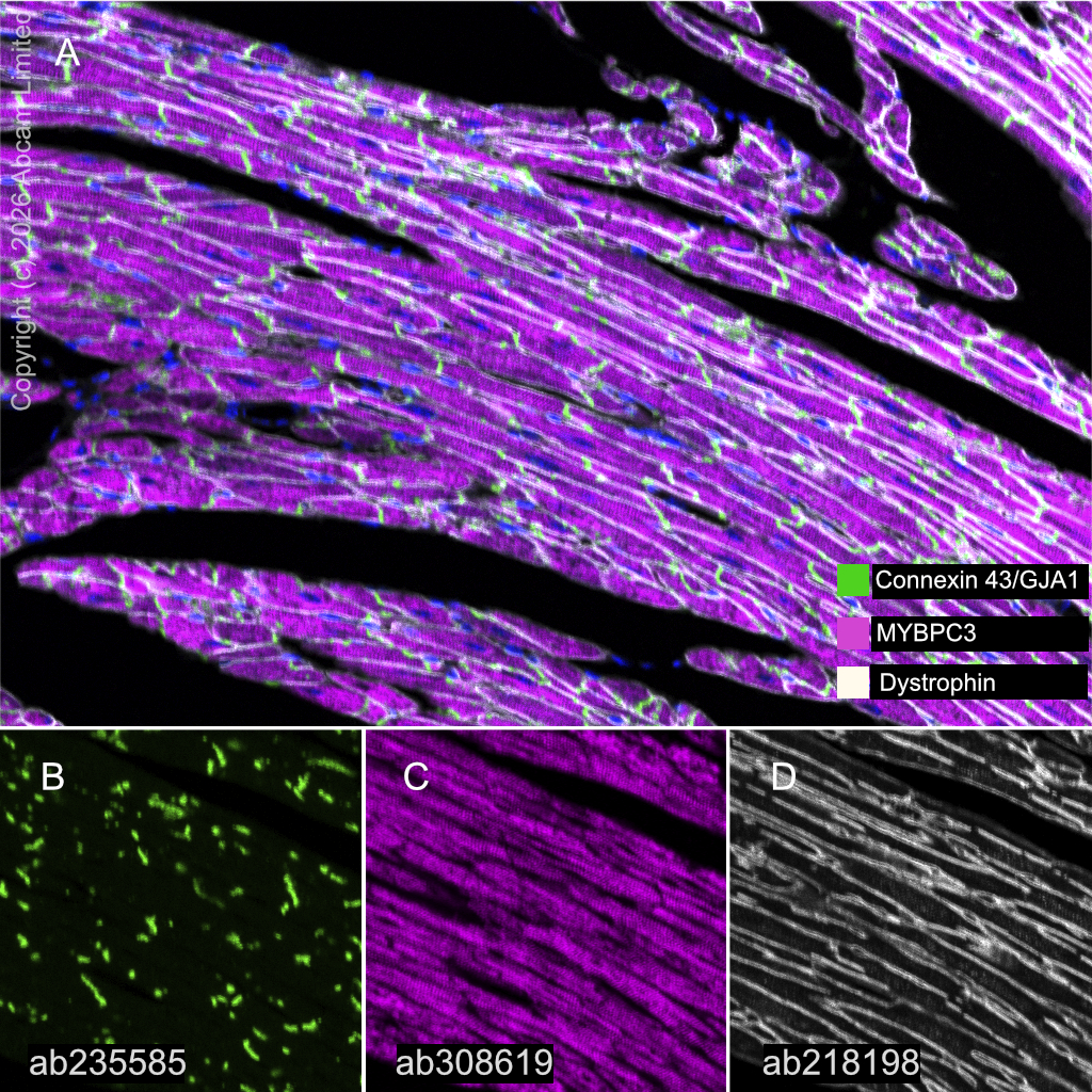 Multiplex immunohistochemistry - Anti-Dystrophin antibody [EPR21189] (AB218198)