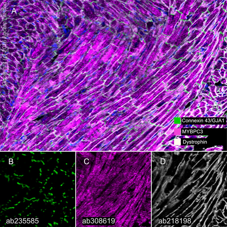 Multiplex immunohistochemistry - Anti-Dystrophin antibody [EPR21189] (AB218198)
