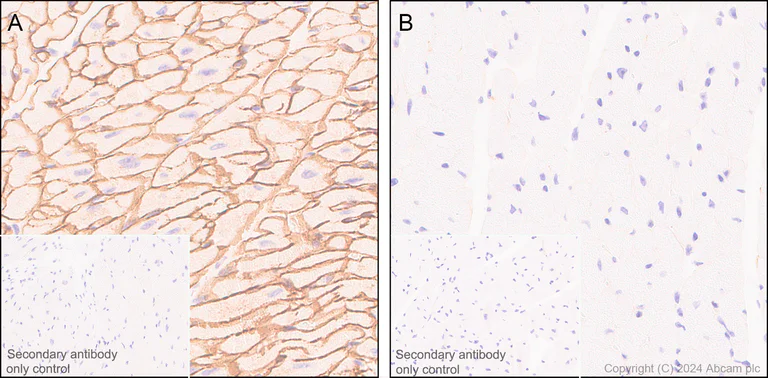Immunohistochemistry (Formalin/PFA-fixed paraffin-embedded sections) - Anti-Dystrophin antibody [EPR21189] - BSA and Azide free (AB230379)