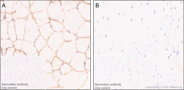 Immunohistochemistry (Formalin/PFA-fixed paraffin-embedded sections) - Anti-Dystrophin antibody [EPR21189] - BSA and Azide free (AB230379)