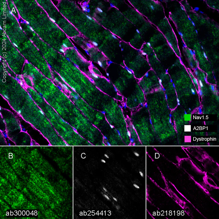 Multiplex immunohistochemistry - Anti-Dystrophin antibody [EPR21189] - BSA and Azide free (AB230379)