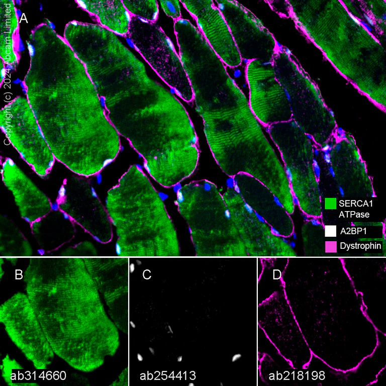 Multiplex immunohistochemistry - Anti-Dystrophin antibody [EPR21189] - BSA and Azide free (AB230379)