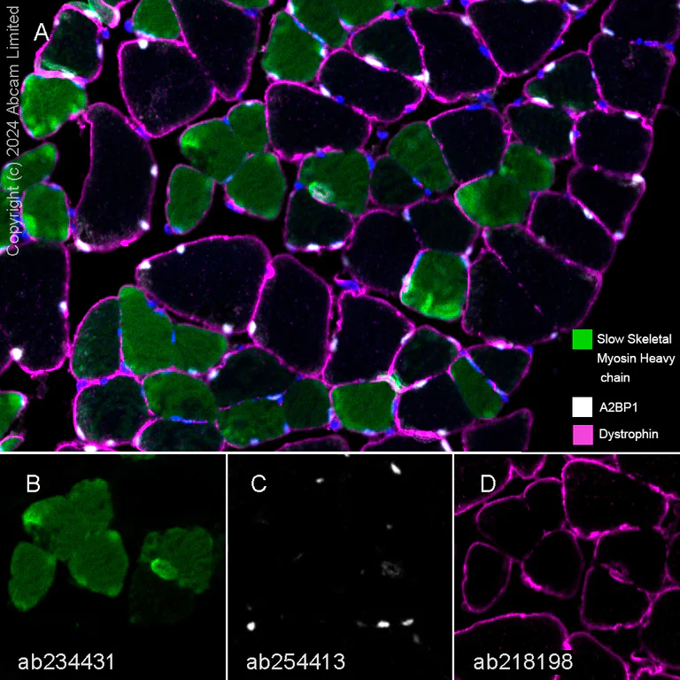 Multiplex immunohistochemistry - Anti-Dystrophin antibody [EPR21189] - BSA and Azide free (AB230379)
