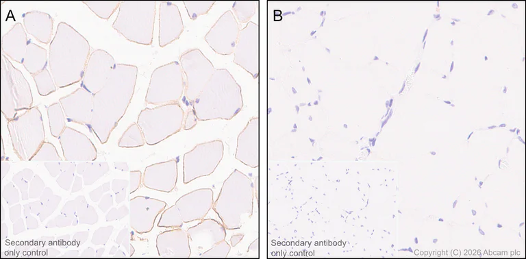 Immunohistochemistry (Formalin/PFA-fixed paraffin-embedded sections) - Anti-Dystrophin antibody [EPR23336-129] - BSA and Azide free (AB275395)