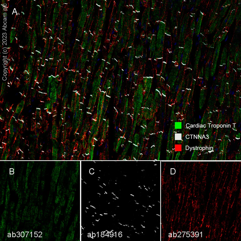 Multiplex immunohistochemistry - Anti-Dystrophin antibody [EPR23336-129] - BSA and Azide free (AB275395)