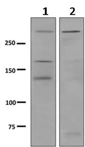 Western blot - Anti-Dystrophin antibody [EPR9598(ABC)] (AB154168)
