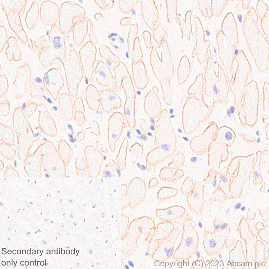 Immunohistochemistry (Formalin/PFA-fixed paraffin-embedded sections) - Anti-Dystrophin antibody [RM1069] (ab315102), expandable thumbnail