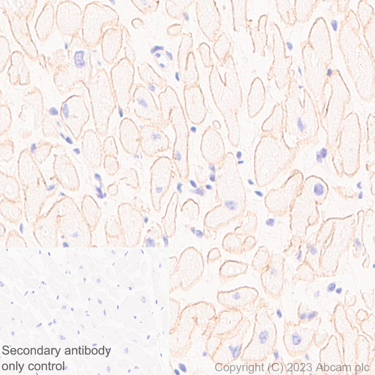 Immunohistochemistry (Formalin/PFA-fixed paraffin-embedded sections) - Anti-Dystrophin antibody [RM1069] (AB315102)