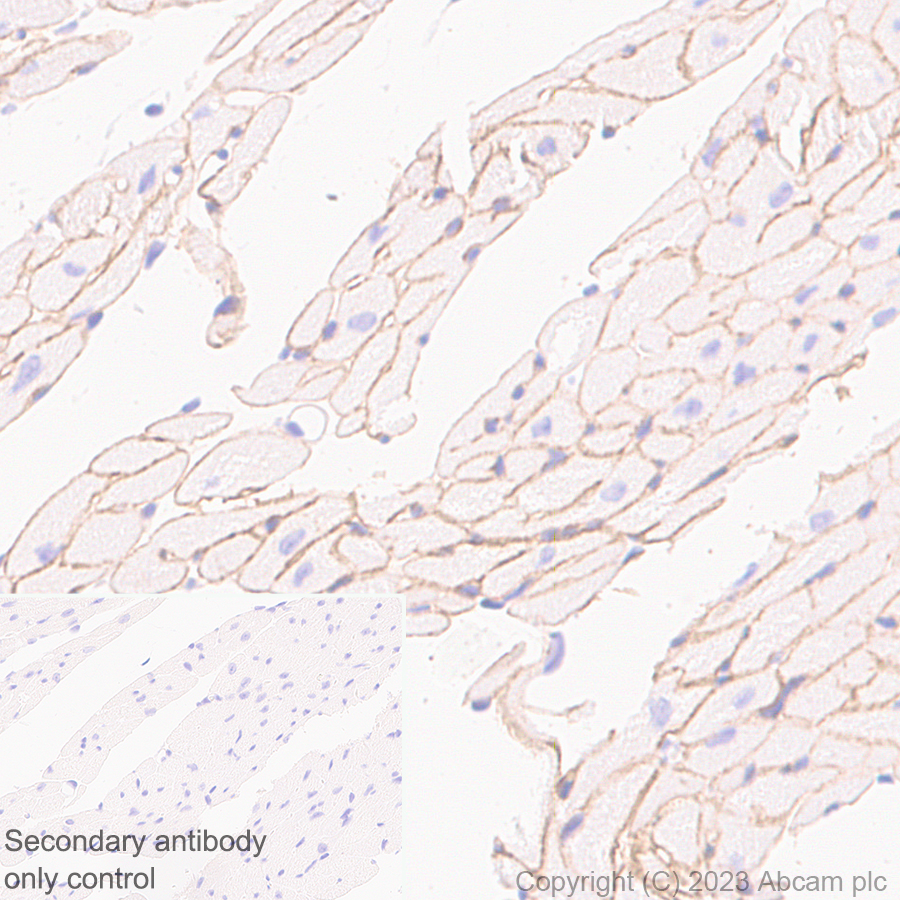 Immunohistochemistry (Formalin/PFA-fixed paraffin-embedded sections) - Anti-Dystrophin antibody [RM1069] (ab315102), expandable thumbnail