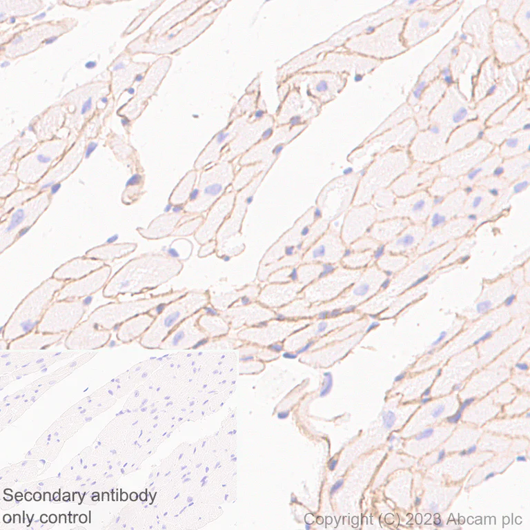 Immunohistochemistry (Formalin/PFA-fixed paraffin-embedded sections) - Anti-Dystrophin antibody [RM1069] (AB315102)