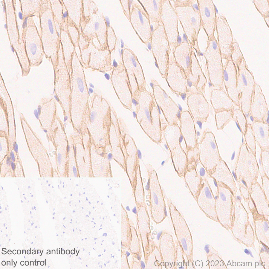 Immunohistochemistry (Formalin/PFA-fixed paraffin-embedded sections) - Anti-Dystrophin antibody [RM1069] (ab315102), expandable thumbnail