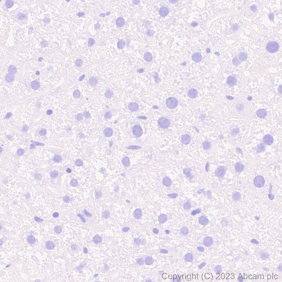 Immunohistochemistry (Formalin/PFA-fixed paraffin-embedded sections) - Anti-Dystrophin antibody [RM1069] (ab315102), expandable thumbnail
