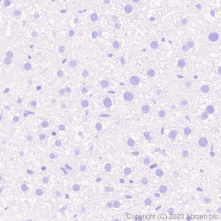 Immunohistochemistry (Formalin/PFA-fixed paraffin-embedded sections) - Anti-Dystrophin antibody [RM1069] (AB315102)