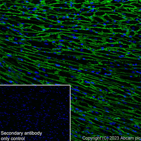 Immunohistochemistry (Frozen sections) - Anti-Dystrophin antibody [RM1069] (ab315102), expandable thumbnail
