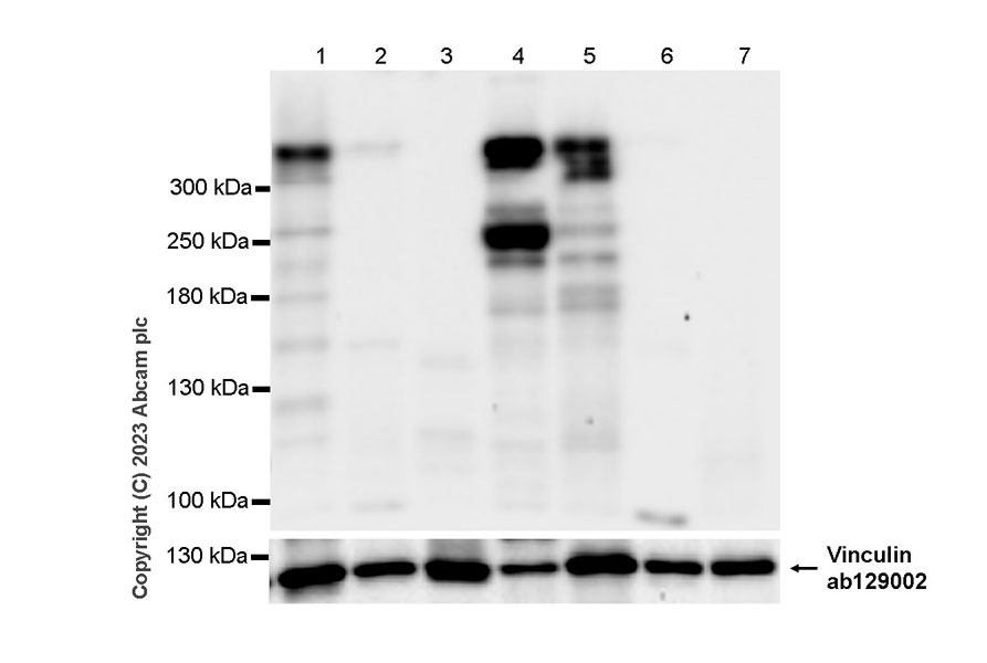 Western blot - Anti-Dystrophin antibody [RM1069] (ab315102), expandable thumbnail
