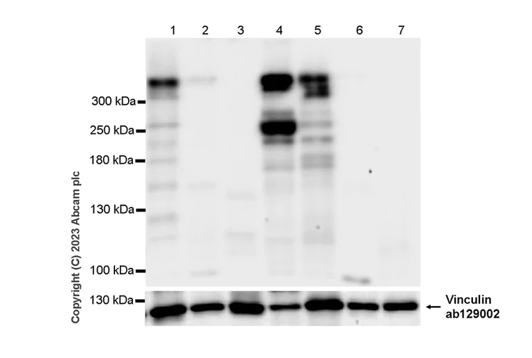 Western blot - Anti-Dystrophin antibody [RM1069] - BSA and Azide free (AB315103)