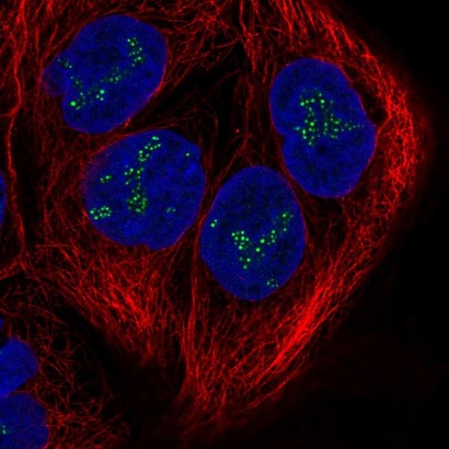 Immunocytochemistry/ Immunofluorescence - Anti-DZANK1 antibody (AB221461), expandable thumbnail