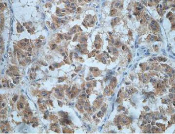 Immunohistochemistry (Formalin/PFA-fixed paraffin-embedded sections) - Anti-DZIP1L antibody (AB201199)