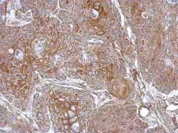 Immunohistochemistry (Formalin/PFA-fixed paraffin-embedded sections) - Anti-DZIP3 antibody (AB155782), expandable thumbnail