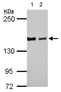 Western blot - Anti-DZIP3 antibody (AB155782), expandable thumbnail