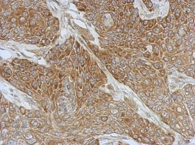 Immunohistochemistry (Formalin/PFA-fixed paraffin-embedded sections) - Anti-DZIP3 antibody (AB229594), expandable thumbnail