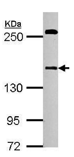 Western blot - Anti-DZIP3 antibody (AB229594), expandable thumbnail