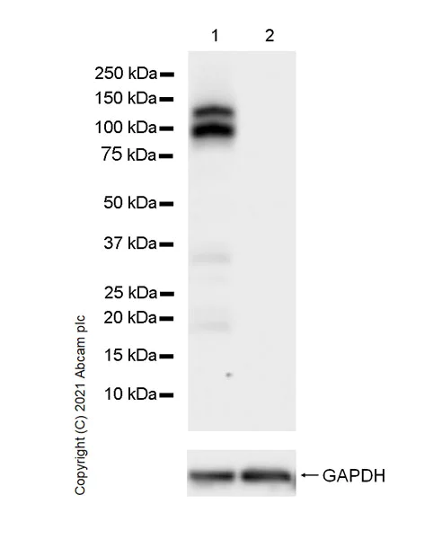 Western blot - Anti-E Cadherin antibody [36/E-Cadherin] (AB287970)
