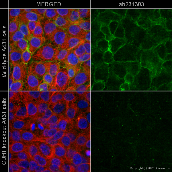 Immunocytochemistry/ Immunofluorescence - Anti-E Cadherin antibody [4A2] (ab231303), expandable thumbnail