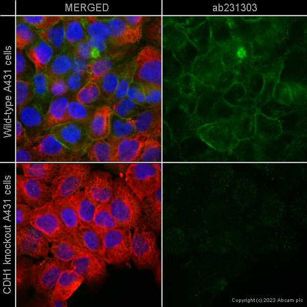 Immunocytochemistry/ Immunofluorescence - Anti-E Cadherin antibody [4A2] (ab231303), expandable thumbnail
