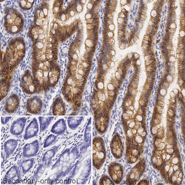Immunohistochemistry (Formalin/PFA-fixed paraffin-embedded sections) - Anti-E Cadherin antibody [4A2] (AB231303), expandable thumbnail