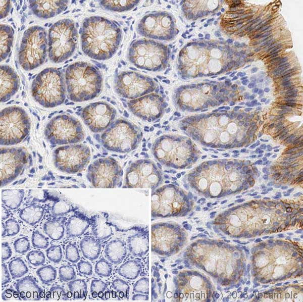 Immunohistochemistry (Formalin/PFA-fixed paraffin-embedded sections) - Anti-E Cadherin antibody [4A2] (ab231303), expandable thumbnail