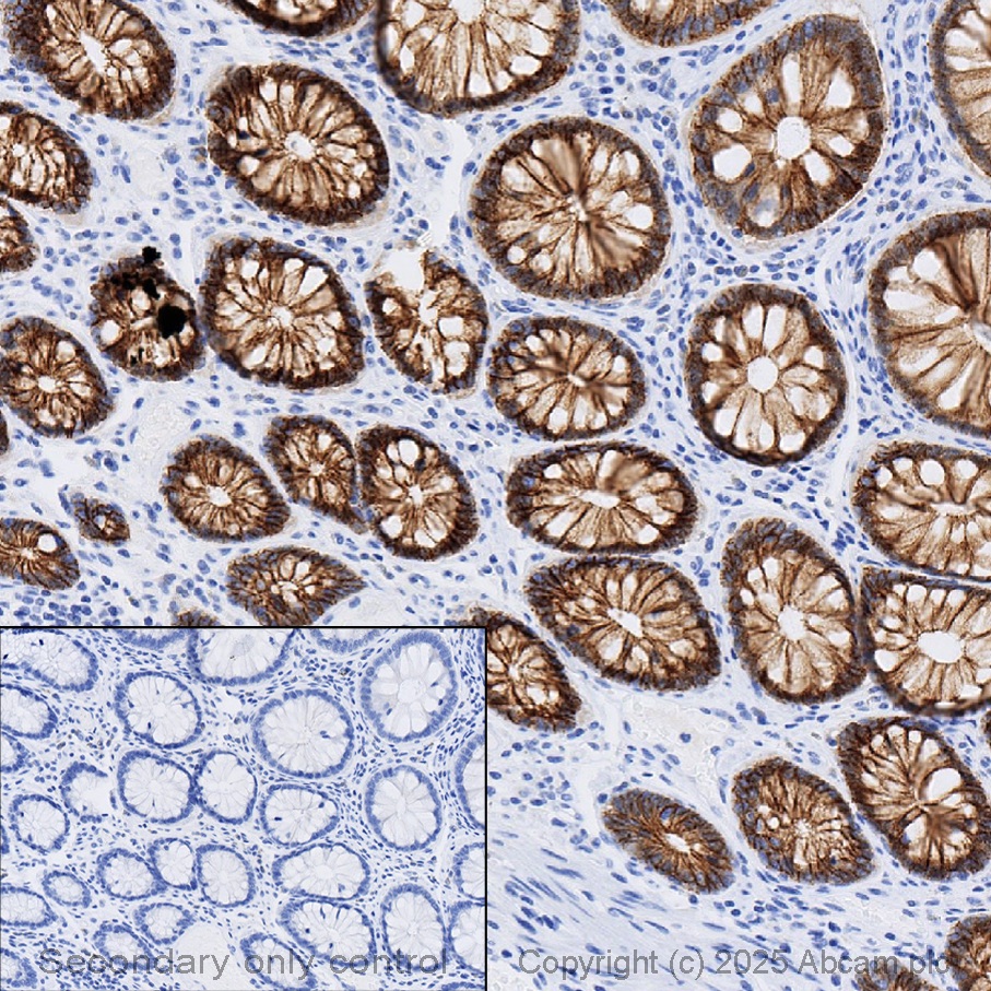 Immunohistochemistry (Formalin/PFA-fixed paraffin-embedded sections) - Anti-E Cadherin antibody [4A2] (AB231303), expandable thumbnail