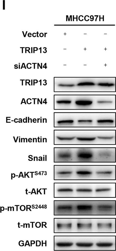 Western blot - Anti-E Cadherin antibody [4A2] (AB231303)