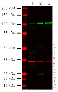 Western blot - Anti-E Cadherin antibody [4A2] (AB231303), expandable thumbnail