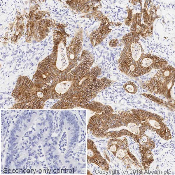 Immunohistochemistry (Formalin/PFA-fixed paraffin-embedded sections) - Anti-E Cadherin antibody [4A2] - BSA and Azide free (AB233766)