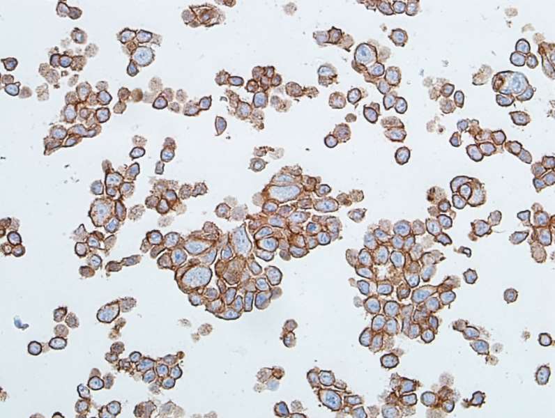 Immunocytochemistry - Anti-E-Cadherin antibody [BLR088G] - BSA free (AB314063), expandable thumbnail