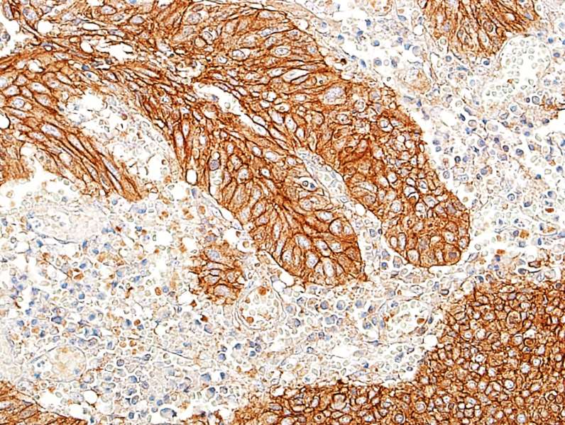 Immunohistochemistry (Formalin/PFA-fixed paraffin-embedded sections) - Anti-E-Cadherin antibody [BLR088G] - BSA free (ab314063), expandable thumbnail