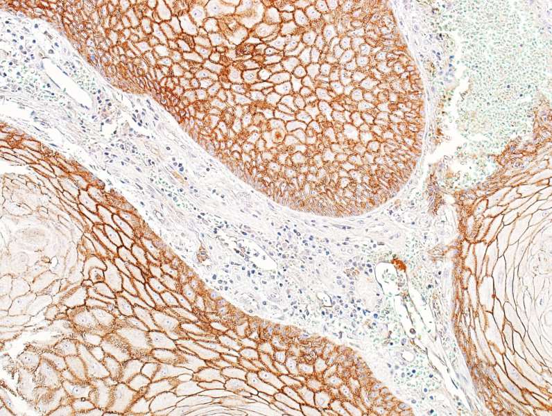 Immunohistochemistry (Formalin/PFA-fixed paraffin-embedded sections) - Anti-E-Cadherin antibody [BLR088G] - BSA free (ab314063), expandable thumbnail