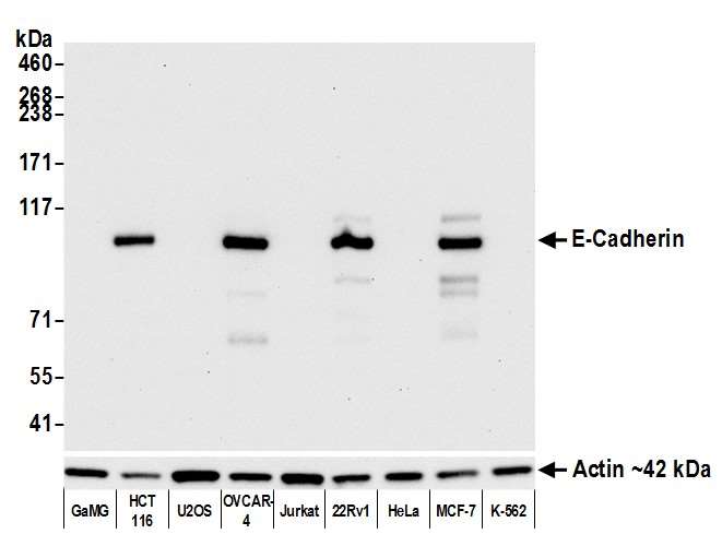 Western blot - Anti-E-Cadherin antibody [BLR088G] - BSA free (AB314063), expandable thumbnail