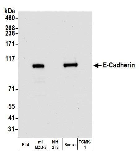 Western blot - Anti-E-Cadherin antibody [BLR088G] - BSA free (AB314063), expandable thumbnail