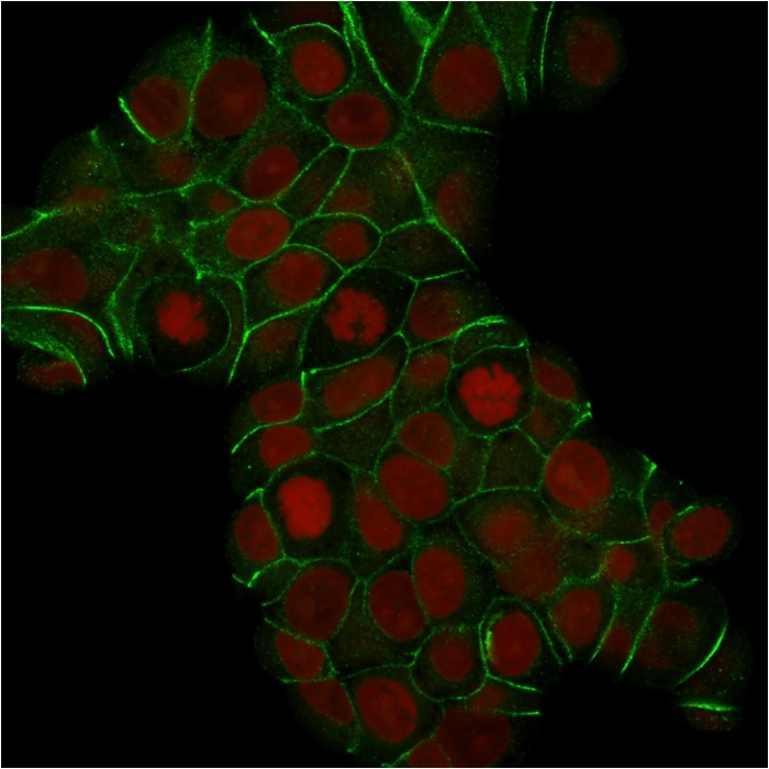Immunocytochemistry - Anti-E Cadherin antibody [CDH1/1525] (AB219332), expandable thumbnail
