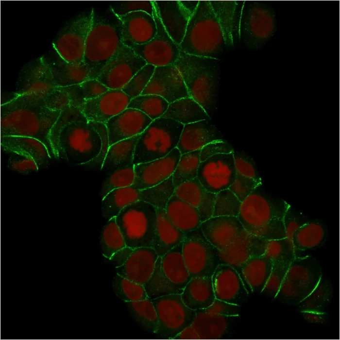 Immunocytochemistry - Anti-E Cadherin antibody [CDH1/1525] (AB219332)