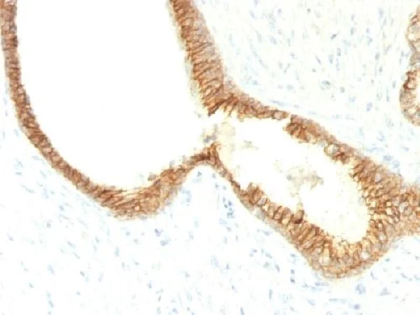 Immunohistochemistry (Formalin/PFA-fixed paraffin-embedded sections) - Anti-E Cadherin antibody [CDH1/1525] (AB219332)