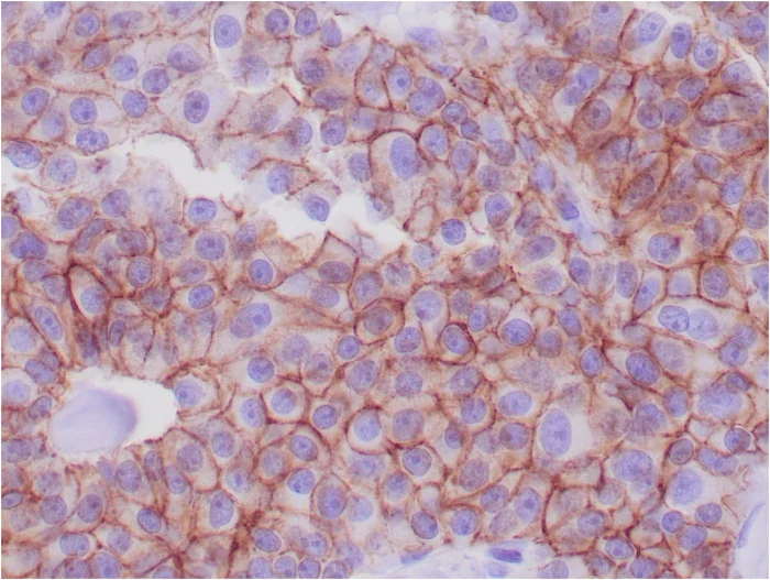 Immunohistochemistry (Formalin/PFA-fixed paraffin-embedded sections) - Anti-E Cadherin antibody [CDH1/1525] (AB219332)